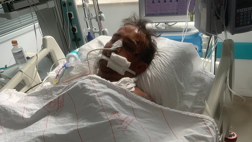 John Kearney was on holiday in Turkey with his friends and girlfriend when he was in a horrific scooter crash in İçmeler