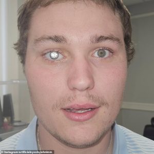 A jewellery store owner from Alabama has given himself an eye-catching look fit for a Bond villain after installing a two-carat diamond into his prosthetic eye