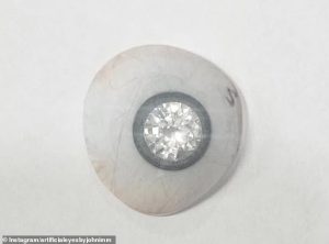 The prosthetic eye includes a large diamond in the iris and cost around $2 million ($1.45 million) to create, according to Mr Jones