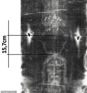 Forensic studies of the Shroud show scalp blood could be reactivated after death through hair wicking and handling, allowing it to transfer across the head and face during burial.