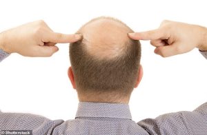 At least half of men over the age of 50 will lose some of their hair just through the ageing process (stock image)