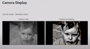 The PRIMA system allows patients with central vision loss to recognise faces