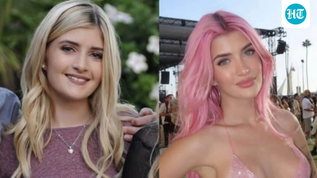From lip fillers to nose jobs: Sami Sheen shares her cosmetic surgery experience on social media.
