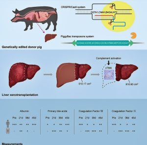 For the first month after surgery, the graft functioned effectively, producing bile and synthesizing coagulation factors. (Photo: Journal of Hepatology / Zhang et al.)