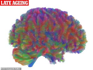 The final stage, known as 'late ageing' (pictured), begins at around 83 years old and is associated with a deterioration of connections between the brain's different regions