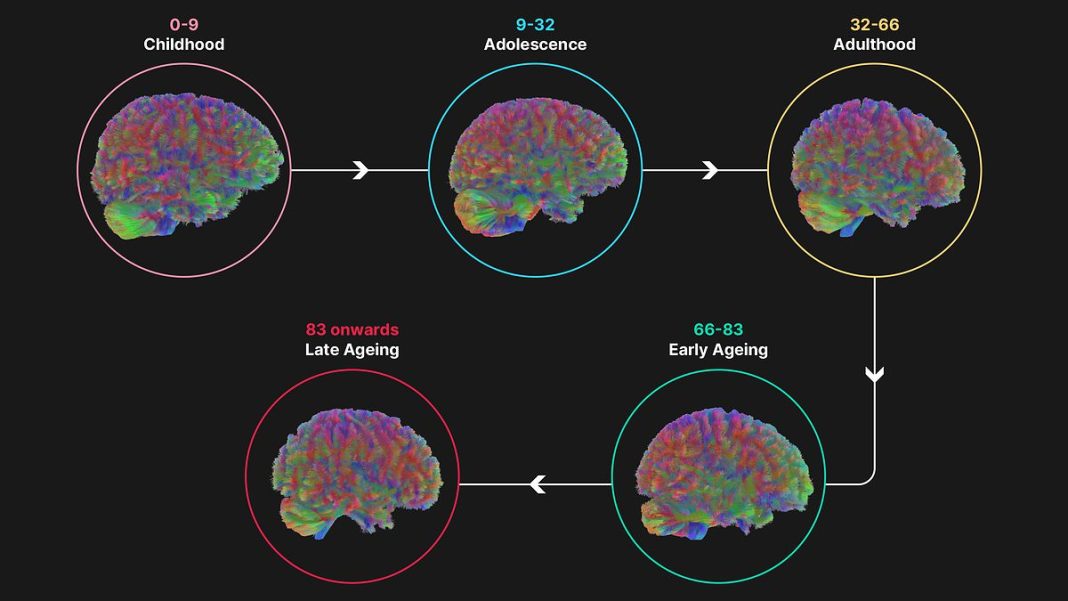 During the first stage, childhood, the brain is rapidly consolidating the connections between different neurons. The excess connections grown as a baby are removed, and only the most active connections remain