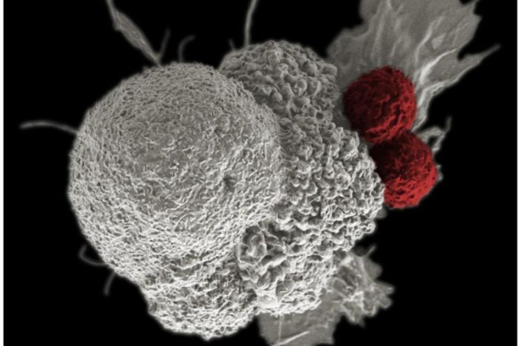 Health: Covid vaccines may help fight cancer