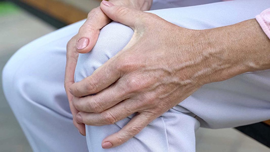 Rheumatoid arthritis often strikes between ages 30 and 60, and women are thrice more likely to develop it than men. Representative image. | Photo Credit: Getty Images/iStockphoto