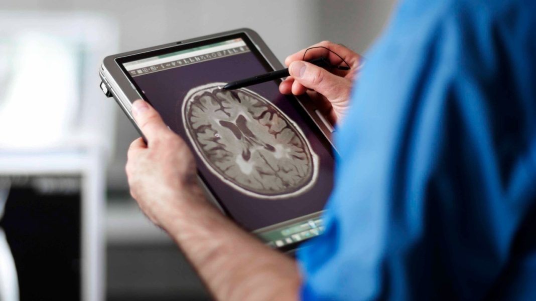 computer with MR-scan of human brain