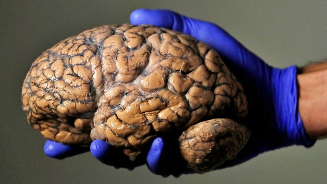 A researcher holds a human brain, part of a collection of more than 3,000 brains at the psychiatric hospital in Duffel, Belgium. (Photo: Reuters)