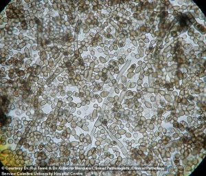 C. sphaerospermum under a microscope. The fungus has been found to turn dangerous gamma rays into energy