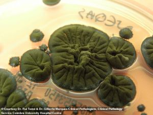 A dark green mold known as Cladosporium sphaerospermum has been found to feed on nuclear radiation, making it a potential building material for future moon bases