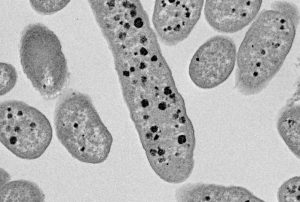 Bacteroides thetaiotaomicron removes protective sulfate groups from intestinal mucin. (Photo: EurekAlert)