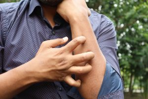 A man in a blue shirt scratching his arm outdoors. (Photo: Pexels)