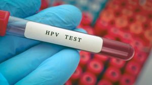 India will begin vaccinating 14-year-old girls against HPV in March. Gardasil 4, a quadrivalent vaccine manufactured by Merck & Co, will be administered free of cost at government health facilities. (Representational image: Getty)