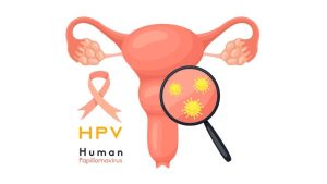 When the HPV vaccine is injected, your immune system sees virus-like particles, which are impostors, and thinks the body is under attack. It immediately starts producing antibodies, which are the body’s internal security guards. (Photo: Getty)