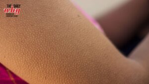 An image of a person feeling goosebumps due to cold temperatures. (Photo: Getty)