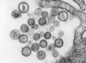 A microscopic view of a number of virus particles of Hantavirus. (Photo: Reuters)