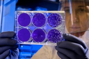 Stem cells are master cells that can grow into any type of blood cell. The bone marrow is the spongy tissue inside bones where these cells are made. (Photo: Unsplash)